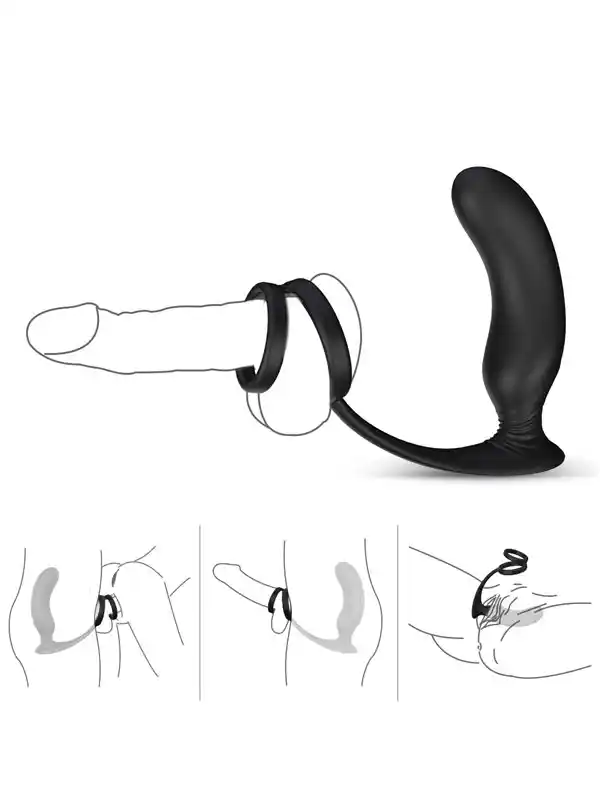 #7839 - NOXXX Halo Penis Halkalı Prostat ve Şarjlı Anal Masaj Vibratörü